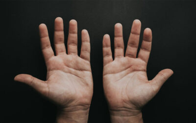 How to care for a broken finger